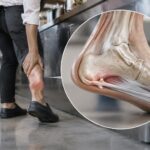 Épine calcanéenne : comment le travail en position debout influence cette affection